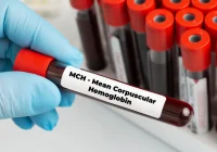 fialetta sangue mch